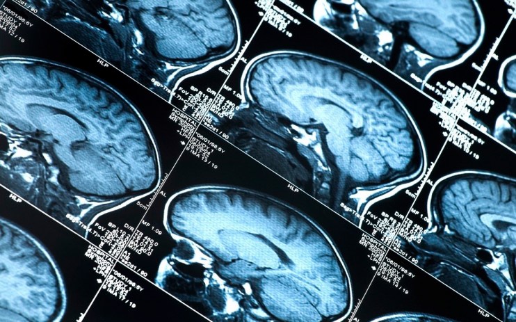 Brain scan image