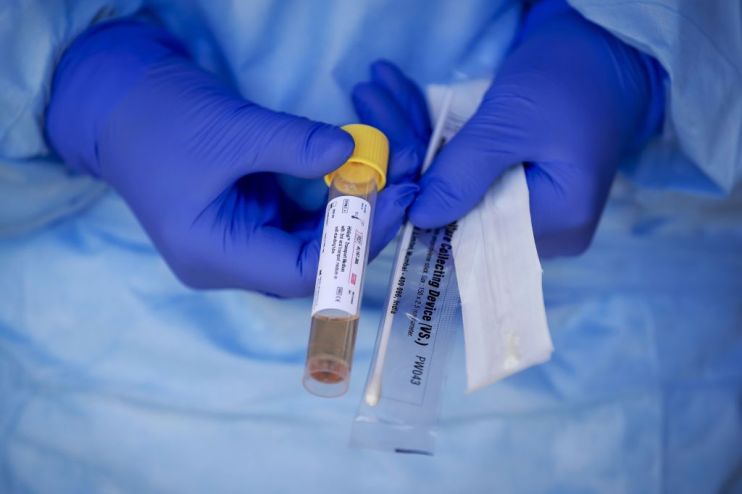 NETHERLANDS-HEALTH-VIRUS