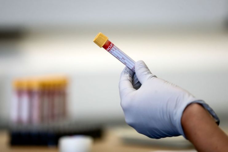 BRITAIN-HEALTH-VIRUS